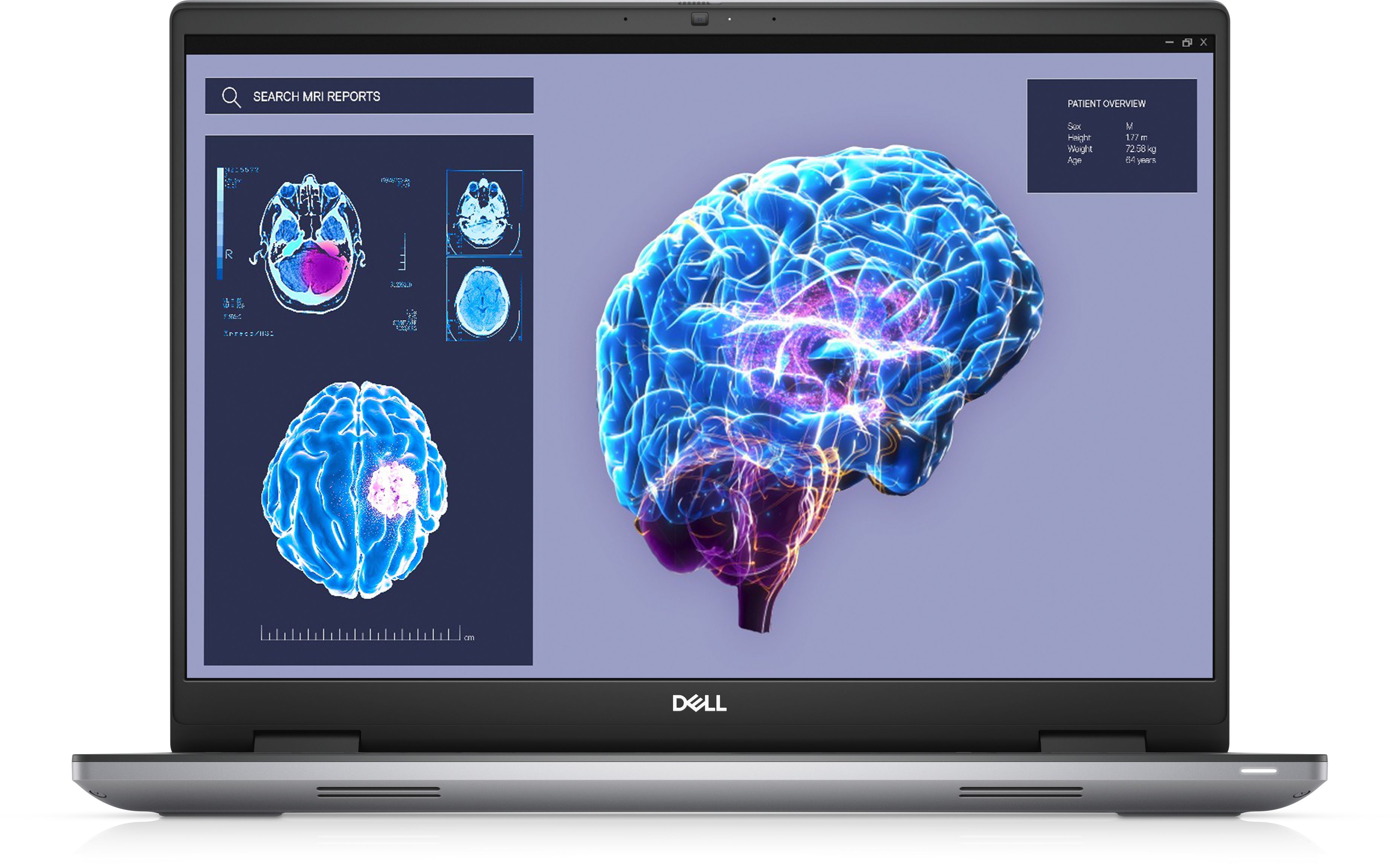 PRECISION 7680 I7-13850HX 32GB/1TB 16IN FHD+ W11P 3Y PROSPT_1