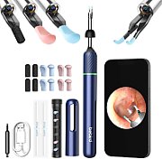 Otoscope Bebird Note5 Pro Blue_3